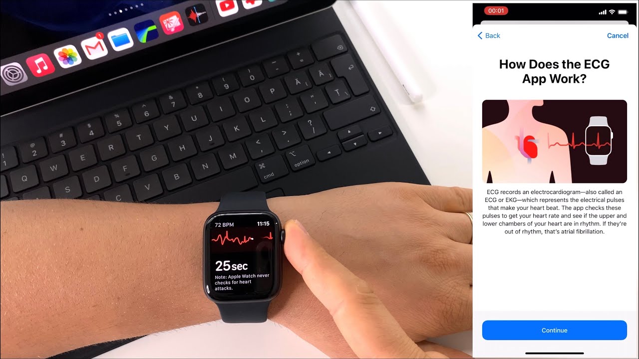 Review Apple Watch 6 - 40mm, space gray, aluminum | specs | unboxing -  YouTube