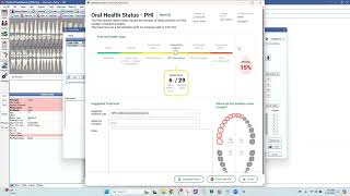 Voice Enabled Perio Charting & PHI Reporting for Open Dental with Denti AI Voice