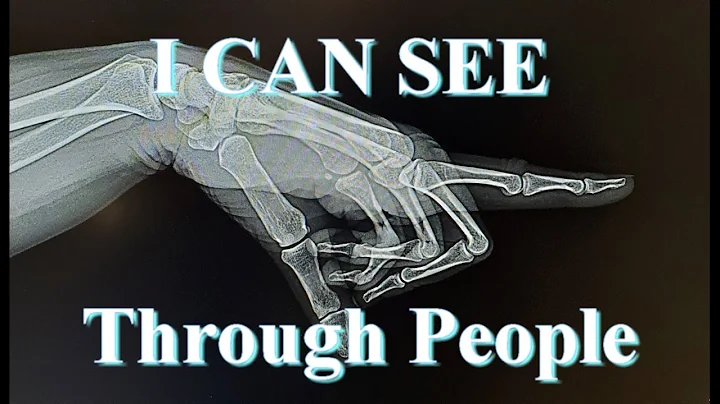 Limited Scope X-Ray License. What is it? Should you get one? Everything you need to know.