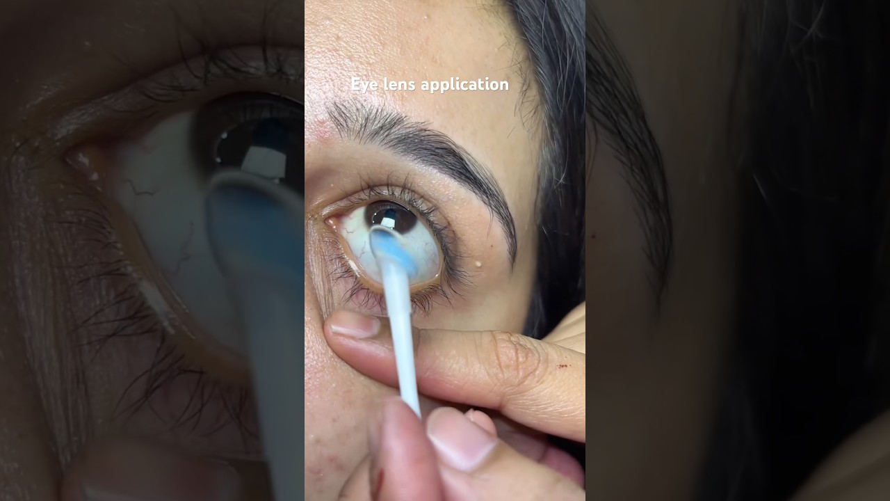 Blue lens for fairtone clients #youtubeshorts #shorts #shorts