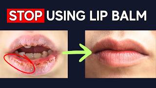 How I Healed My Dry, Cracked, Chapped Lips