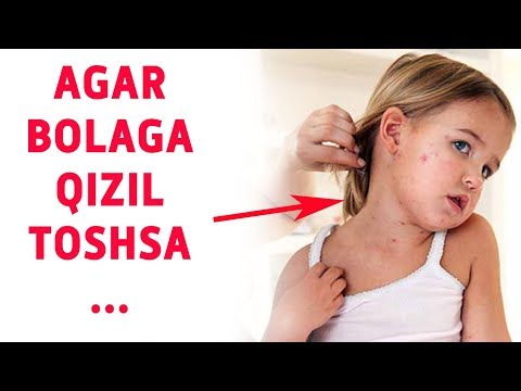 Video: Qizil uchli fotiniyani kesish - Photinia butalarini kesish bo'yicha maslahatlar