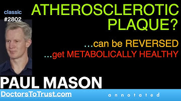 PAUL MASON | ATHEROSCLEROTIC PLAQUE?    …can be REVERSED …get METABOLICALLY HEALTHY