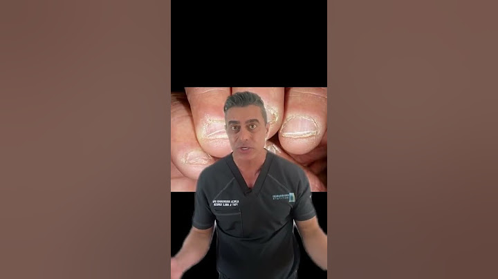 Stop Biting Your Nails!