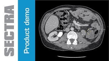 Sectra Lesion Tracking