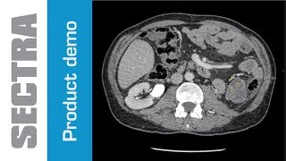 Sectra Lesion Tracking