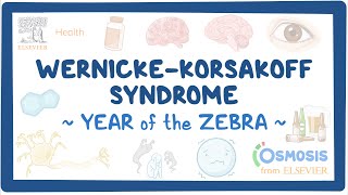 Wernicke Korsakoff Syndrome (Year of the Zebra)