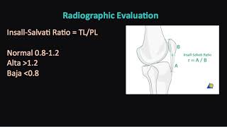 Patella Fractures