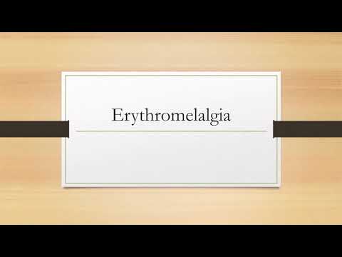 Erythromelalgia