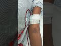 dialysis process💉💉#dialysislife #viral #viralshorts