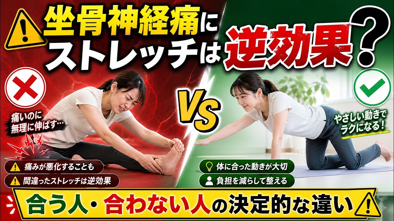 坐骨神経痛にストレッチは逆効果?合う人・合わない人の決定的な違い