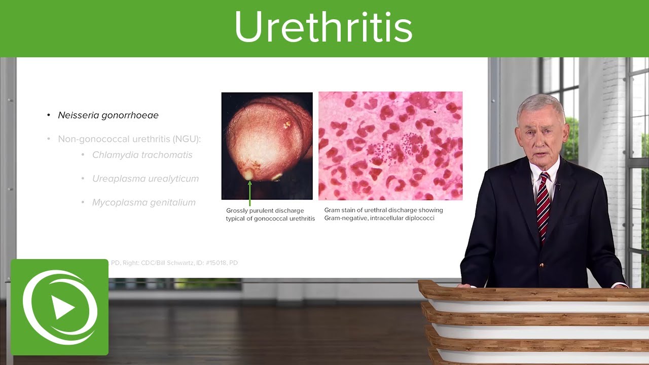 ⁣Urethritis: Definition & Pathology – Infectious Diseases | Lecturio