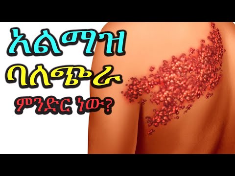 ቪዲዮ: አልማዝ እንዴት እንደሚሰልፍ