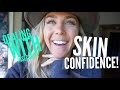 Dealing with Insecurity! Skin Confidence even when your skin isn't perfect...