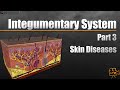 Integumentary System Diseases Quiz
