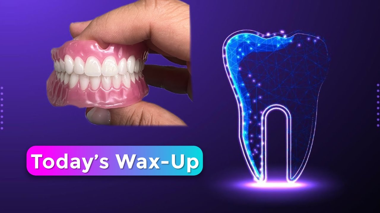 3-Minute Wax-Up | From Start to Try-In