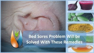 Bed Sores Problem Will be Solved With These Remedies