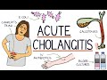 Understanding Acute Cholangitis (Ascending Cholangitis)