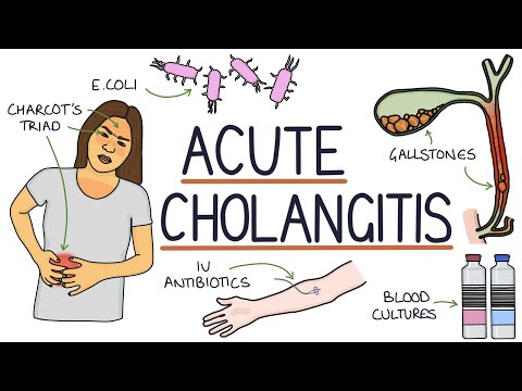 Video: Spôsobuje cholangitída hnačku?