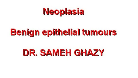 GENERAL PATHOLOGY 44 : neoplasia part 3 ( benign epithelial tumours ) DR SAMEH GHAZY - DayDayNews