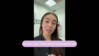Что делать с мимическими морщинами 🤨 #косметология #казахстан#морщины#влог#алматы#юмор#ботокс