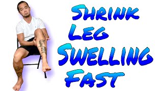 Lymphedema | Reduce Leg Swelling Fast