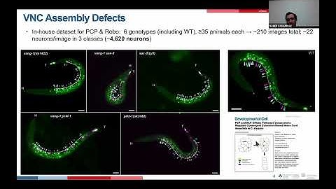 VNC-Dist: Towards a Fully Automated Machine Learning-based Pipeline for Analyzing Neuronal Position