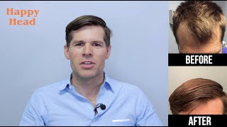 Happy Head Testimonial Video #24