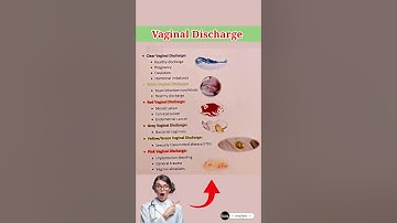 Types of Vaginal Discharge  #medical #information #medicaleducation