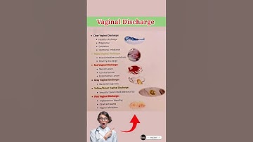 Types of Vaginal Discharge  #medical #information #medicaleducation