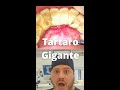  trtaro enorme  sujeira endurecida remoo de clculo dental