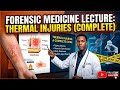 THERMAL INJURIES COMPLETE FORENSIC MEDICINE MARROW