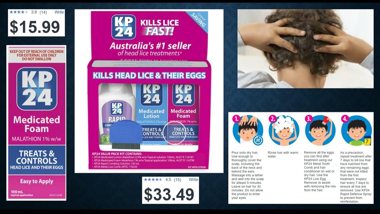 KP24, malathion foam, head lice, repeat in 7 days, massage, rinse