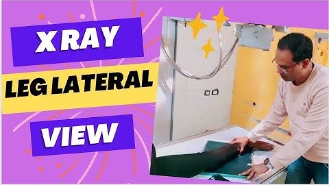X RAY LEG ( TIBIA FIBULA ) LATERAL VIEW #xray #legs #lateral #view #views How to do leg lateral view