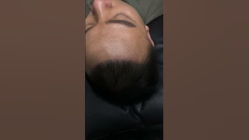 Xăm tóc hói chữ M #reviewxămtóc  #xămtóc