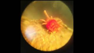 Красный клещик под микроскопом | Red mite under the microscope