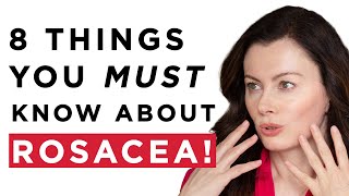 Rosacea  The 8 Things Everyone Needs To Know | Rosacea Awareness Month | Dr Sam Bunting