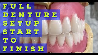 Full Denture Setup From Start To Finish