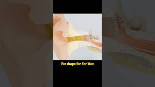 How to use ear drops for wax? #entcare #entdoctor #earsurgery #prominentears