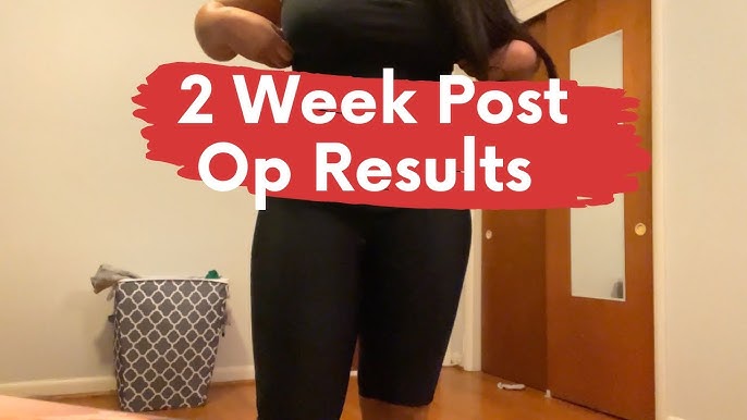 Week 16 SonoBello Body Update !What Happens when you STOP wearing