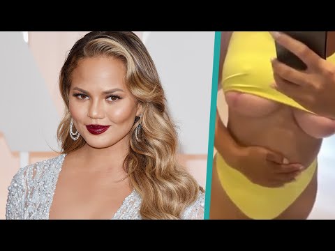 Video: Model Chrissy Teigen Proved To All Doubters That She Really Reduced Her Breasts