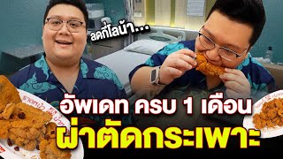 รีวิว ครบรอบ 1 เดือน ผ่าตัดลดขนาดกระเพาะ  EP. 2