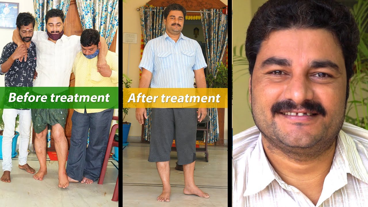 Best Ayurvedic Treatment for Paralysis in Vijayawada Video 5, Call