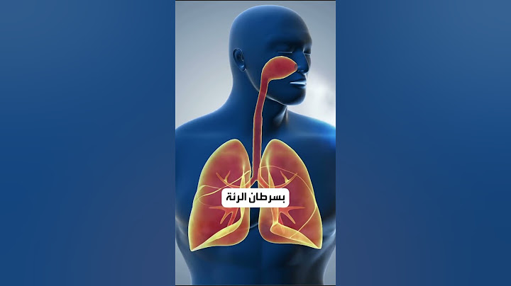 نقص هذه الفيتامينات قد يسبب السرطان