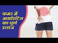 Hip arthritissymptoms and treatment   joint pain      cure 91