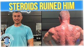 Body Builder Shows the End Result of UsingSteroids