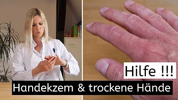 Welche Salbe bei Ekzem am Finger?