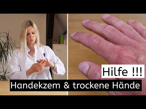 Video: Stark rissige Hände heilen - Gunook