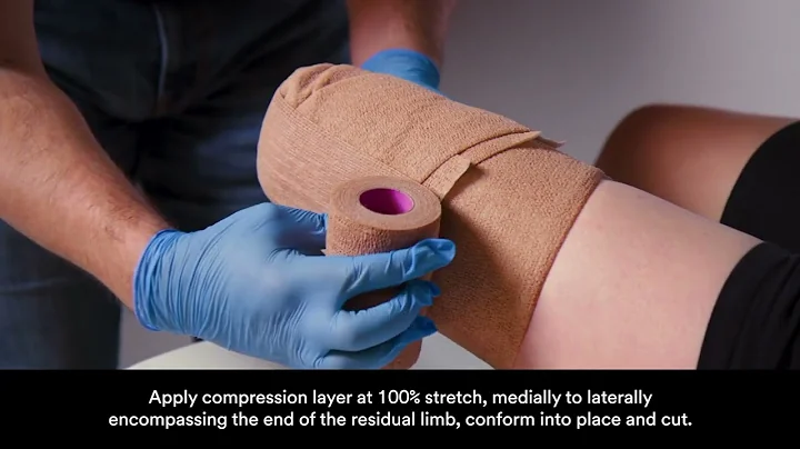 Compression System Application Video. Amputated Limb