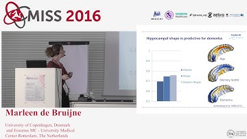 [MISS 2016] Marleen de Bruijne - Learning imaging biomarkers: challenges and pitfalls